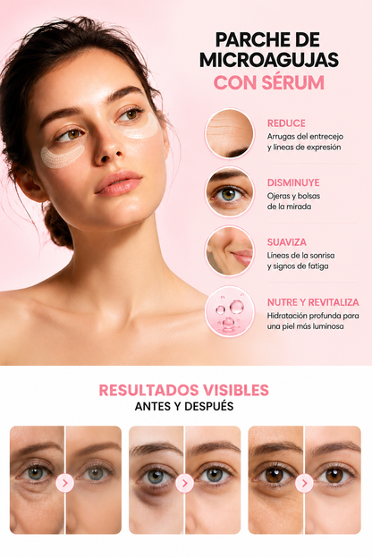NOVA® Microagujas para ojeras y bolsas