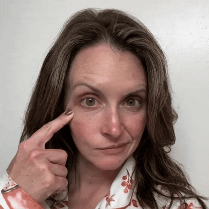 NOVA® Microagujas para ojeras y bolsas