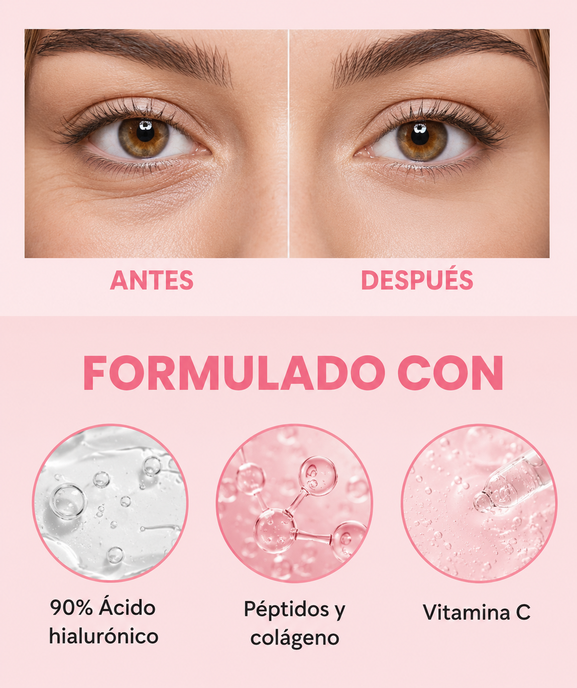 NOVA® Microagujas para ojeras y bolsas