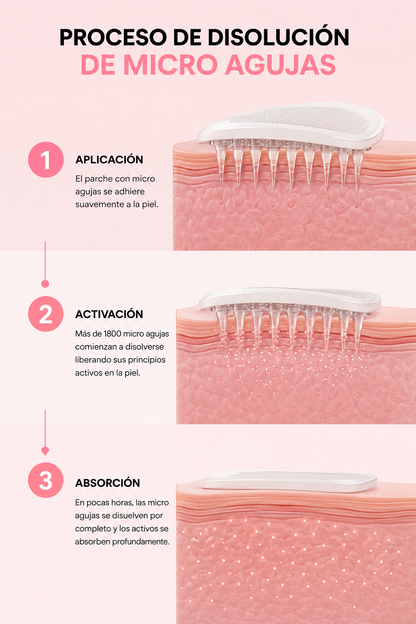 NOVA® Microagujas para ojeras y bolsas